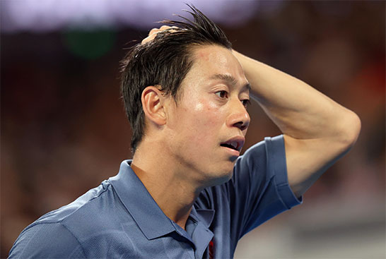 錦織圭